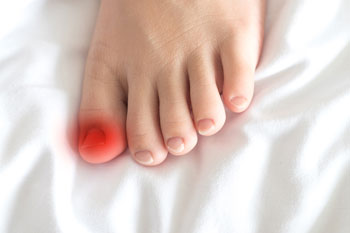 Ingrown toenail treatment at Premier Foot Clinic in Clinton, MS